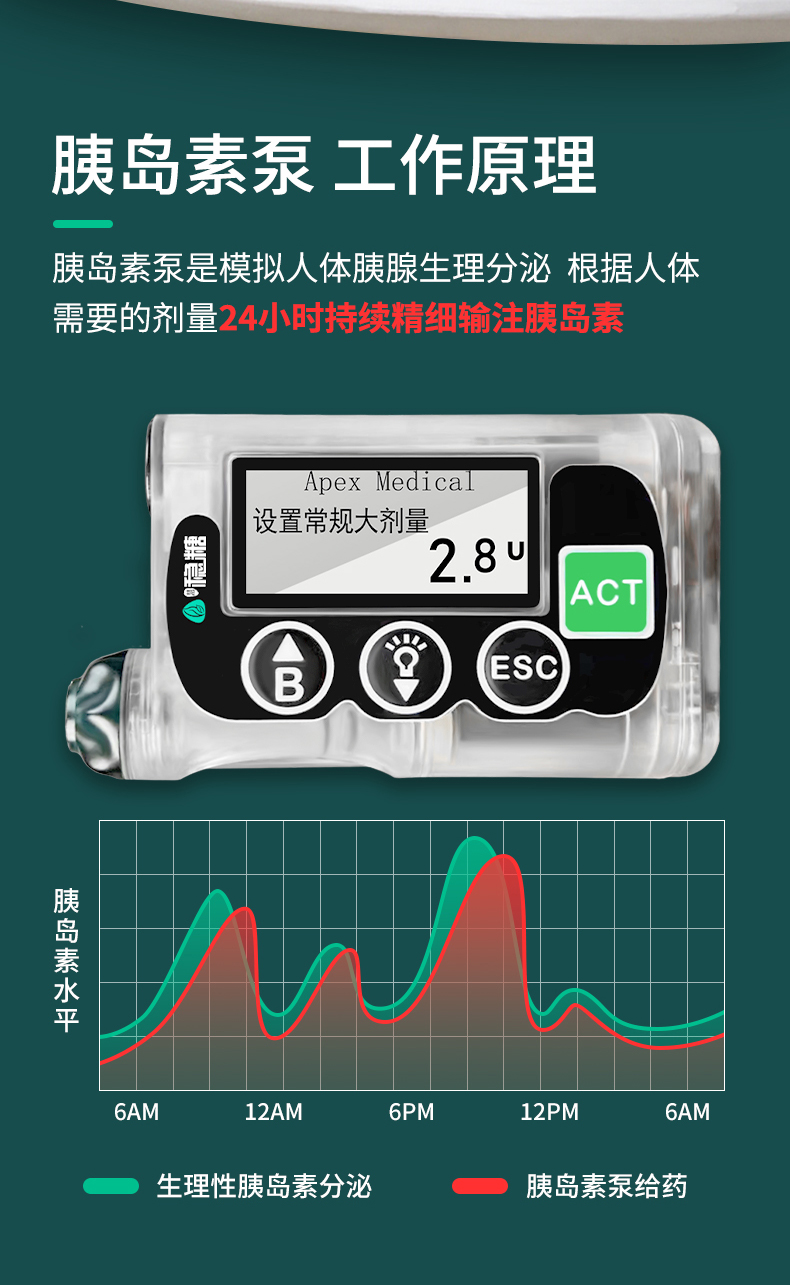 最新全自動胰島素泵，糖尿病管理的革命性進步，全自動胰島素泵，糖尿病管理的突破性革新