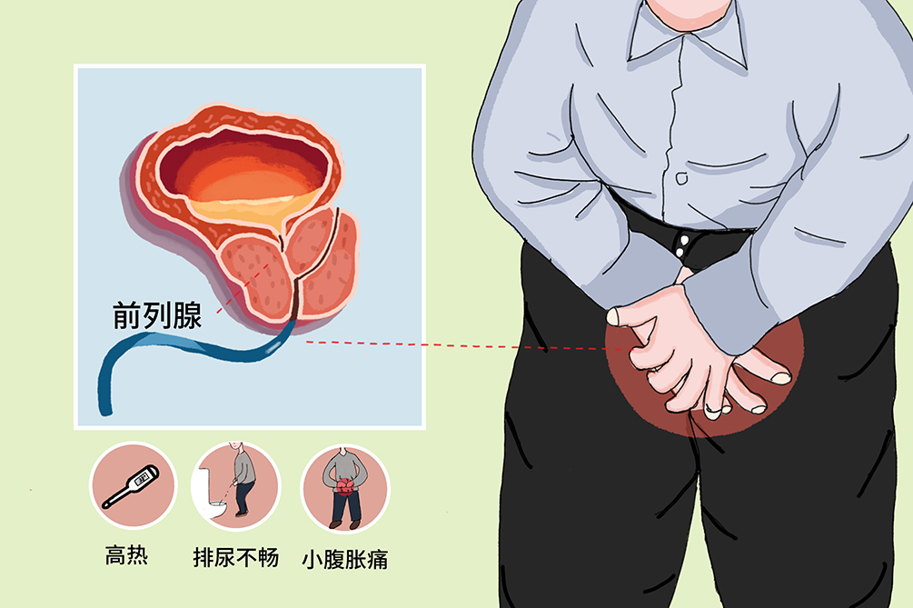 前列腺炎的緩解方法，了解、預(yù)防與改善，前列腺炎緩解方法，了解、預(yù)防與改善措施