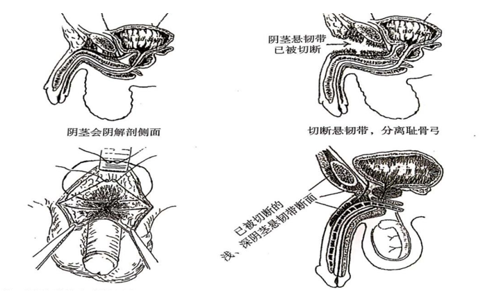 男性增大手術(shù)靠譜嗎？深度解析與探討，男性增大手術(shù)深度解析，可靠性與風險探討